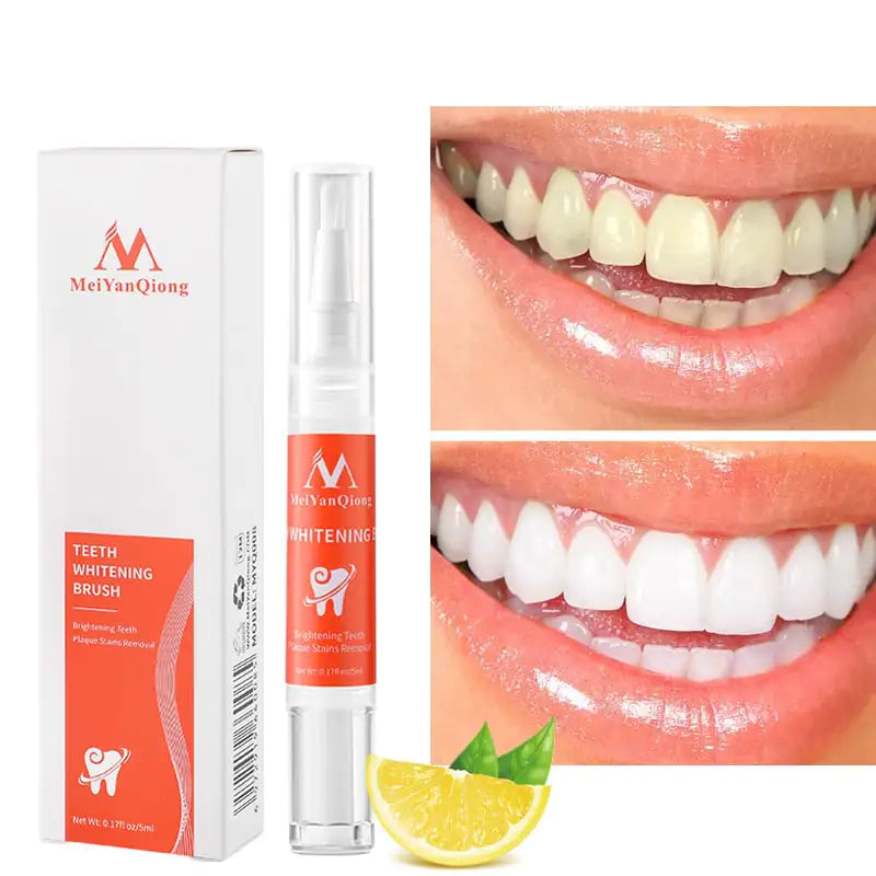Whitening Pen - Verlicht Je Glimlach